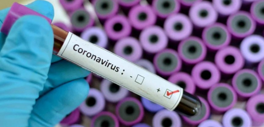 HNSC elabora protocolo de atendimento a pacientes com suspeitas de coronavírus