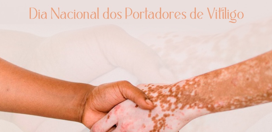 Vitiligo: entenda a doença